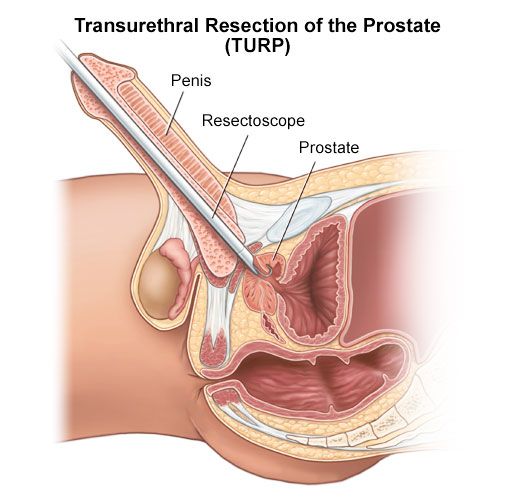 Surgical Procedures