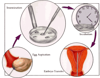 IVF Treatment Cycle