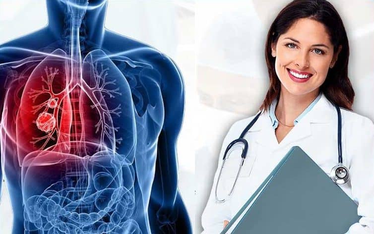 Lung Cancer Treatment in India