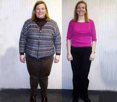 Minimally invasive weight loss surgery in india
